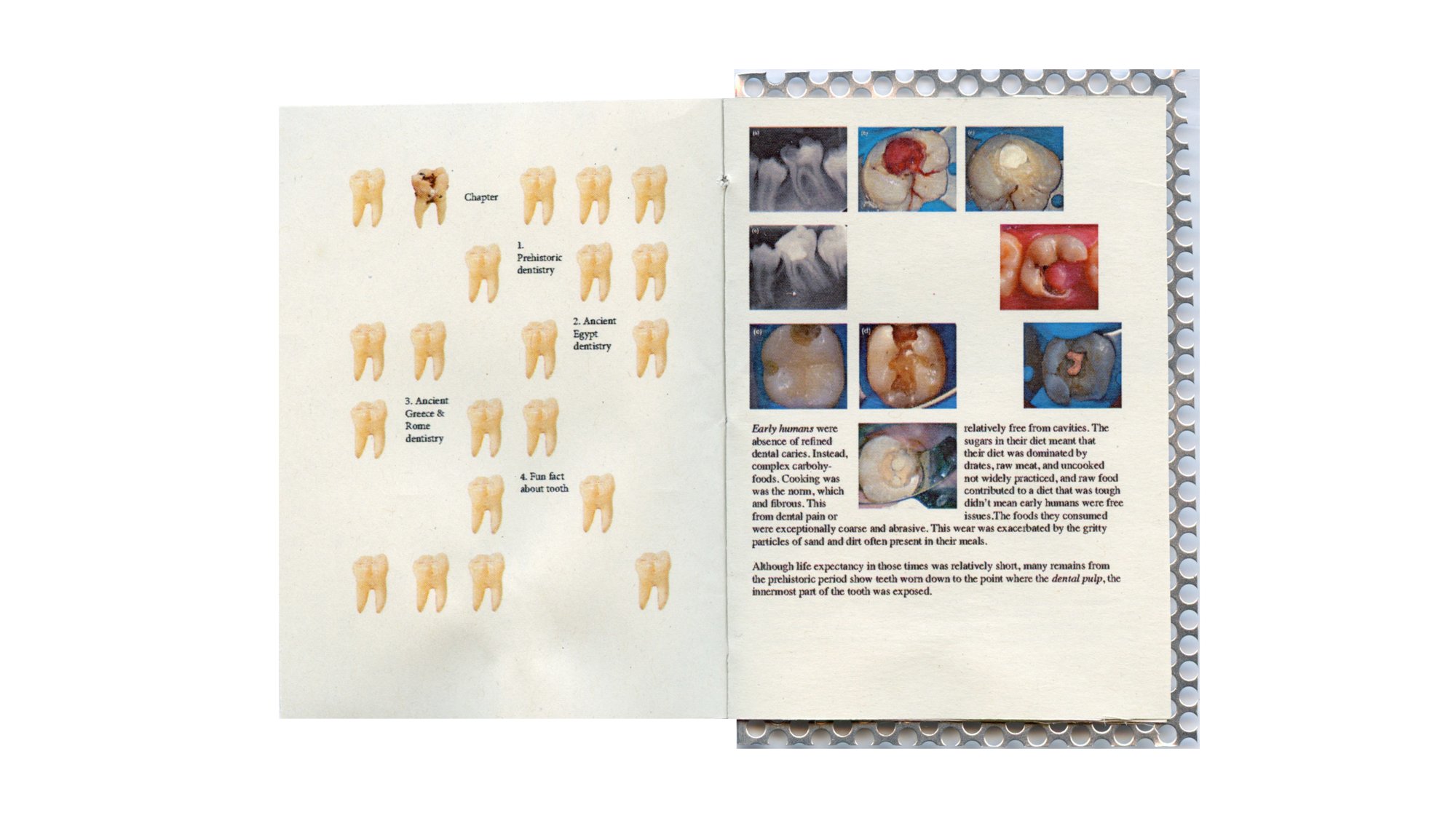 Tooth, image 2