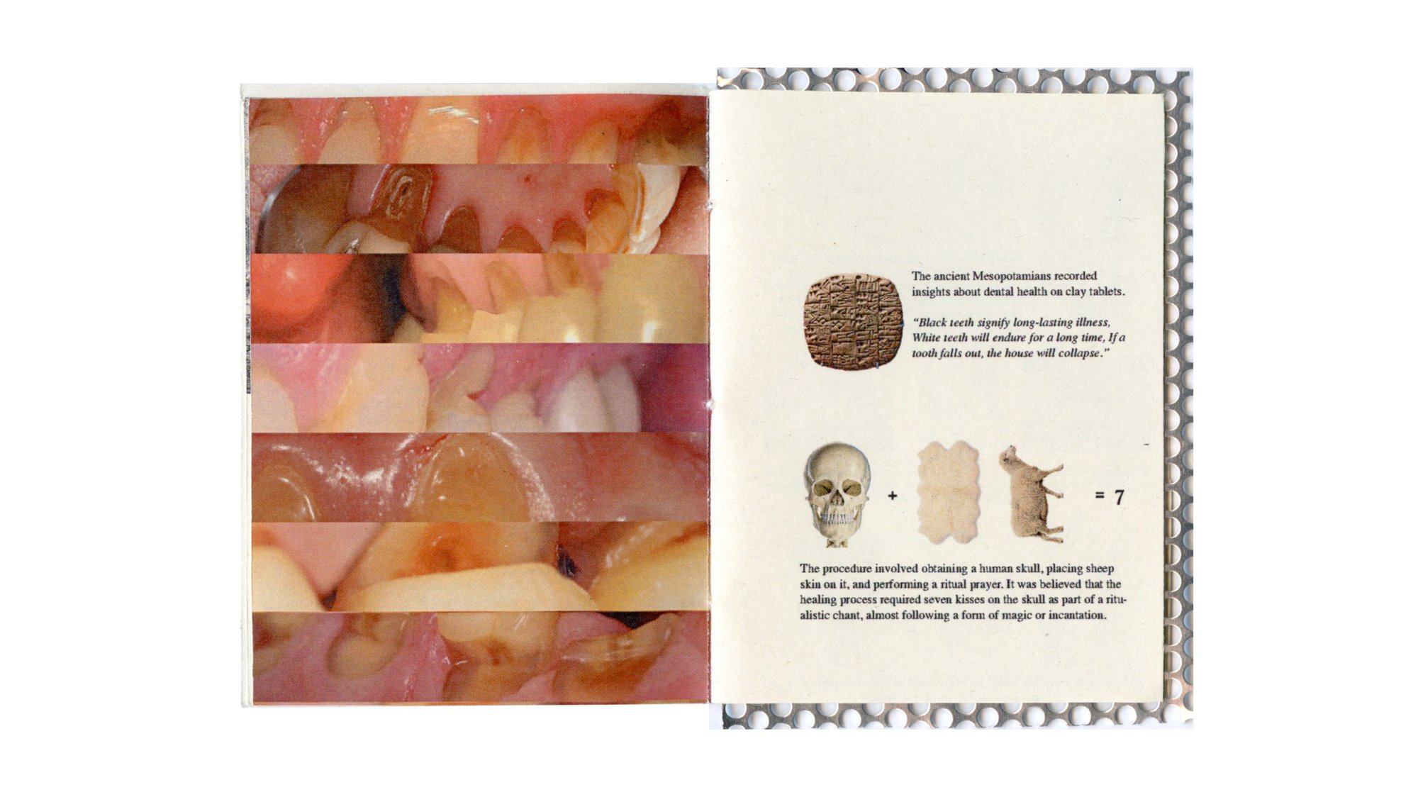 Tooth, image 4