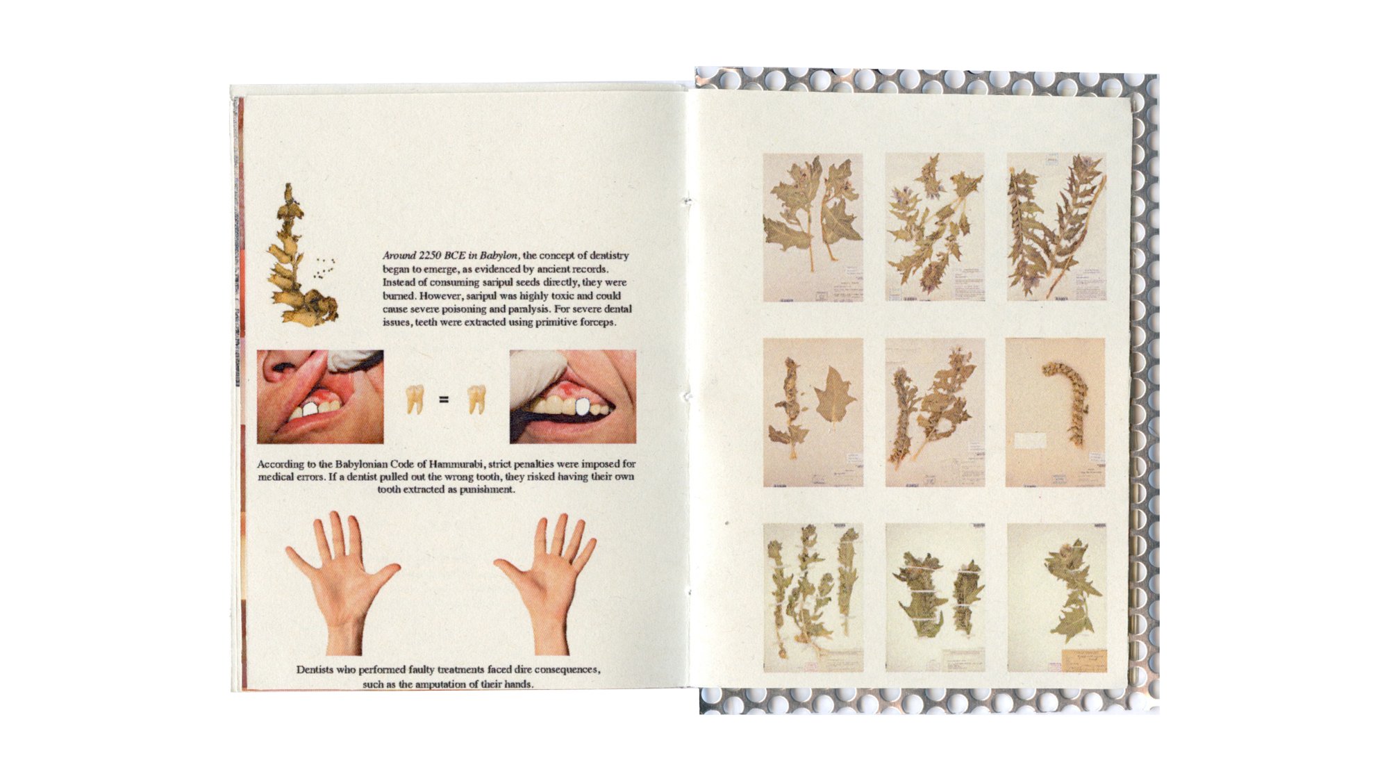 Tooth, image 5
