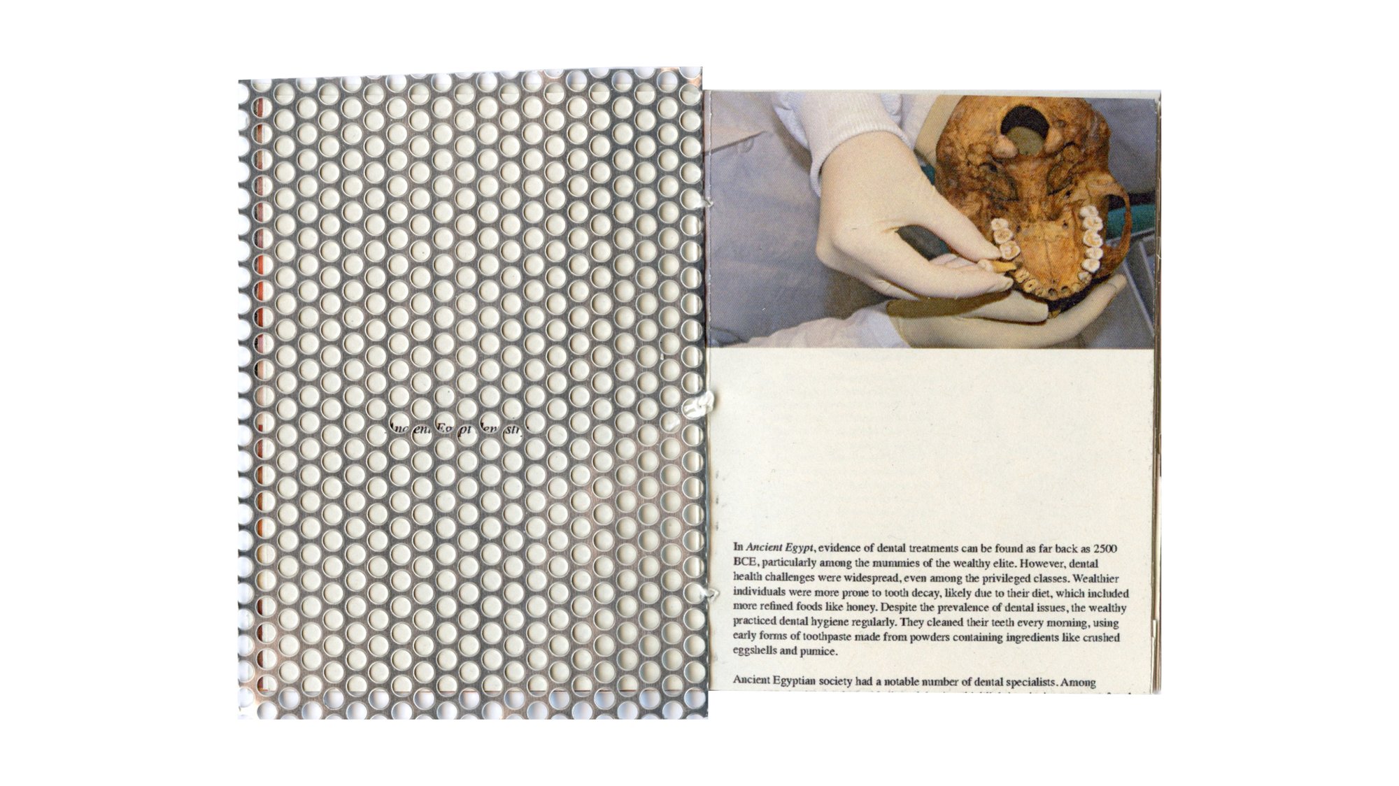 Tooth, image 7